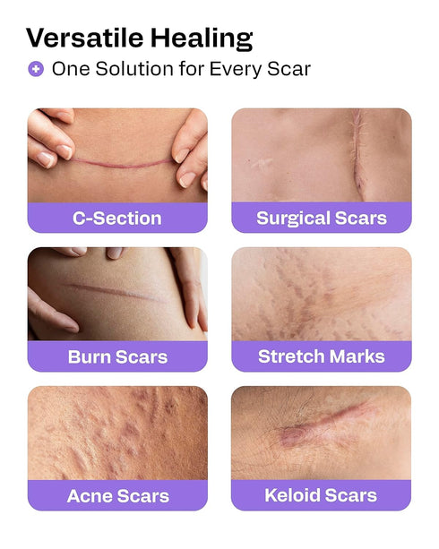 AWD Silicone Scar Sheets for Surgical Scars - Seamless Medical Grade Silicone Scar Tape for C Section, Tummy Tuck Tape - Silicone Skin Patches Aft...