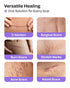 AWD Silicone Scar Sheets for Surgical Scars - Seamless Medical Grade Silicone Scar Tape for C Section, Tummy Tuck Tape - Silicone Skin Patches Aft...