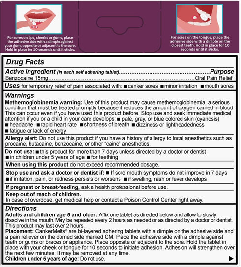Oracoat® CankerMelts® Stick-On Melts™ Mouth Sore Treatment, 20 Count...