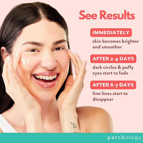 Patchology Hydrating Under Eye Patches for Dark Circles, Serve Chilled Hyaluronic Acid Serum Under Eye Mask protects and softens skin, Rose Eye Ma...