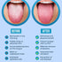 Tongue Cleaner,Tongue Scraper Cure Bad Breath,Tongue Cleaners Stainless Steel,Tongue Scrapers for Adults & Kids Fresher Breath in Seconds by AARAM...
