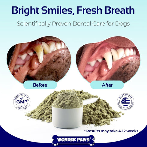Dental Powder for Dogs – Teeth Cleaning & Dental Care Made Easy – Removes Plaque, Tarter, Stains & Freshens Breath – Plaque & Tartar Remover for D...