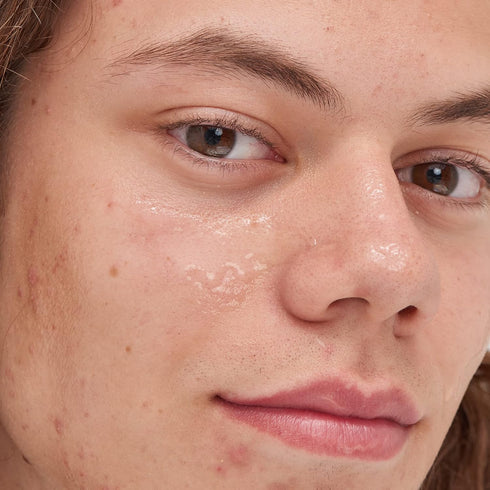 The INKEY List Beta Hydroxy Acid (BHA) Serum, Face Exfoliant for Normal, Oily or Dry Skin, Target Pores and Blackheads, 1.01 fl oz...