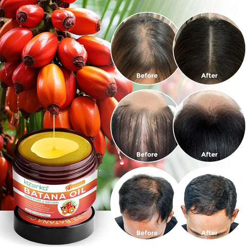 Raw Batana Oil for Hair Growth,100% Pure Natural Batana Oil from Honduras, Eliminate Hair Split Ends, Promotes Hair thickness for All Hair Types 4...