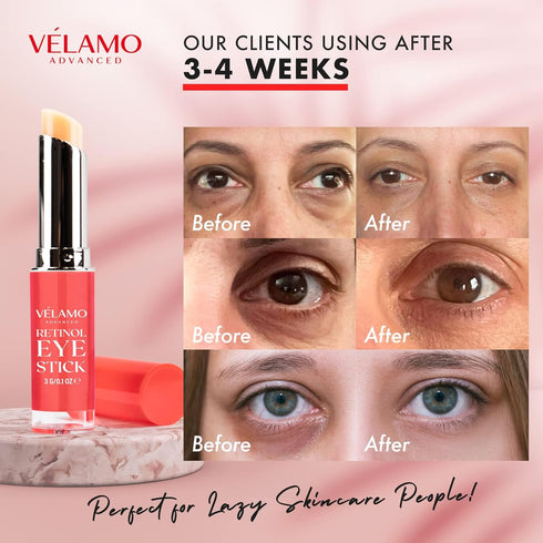Retinol Eye Stick, Retinol Eye Cream, Retinol Cream, Retinol Face Cream, Under Eye Cream Anti Aging, Eye Cream, Brightening Eye Balm Reduces Fine ...