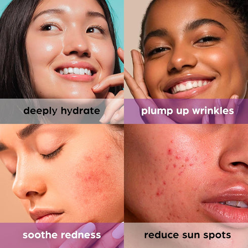 50% Beta Glucan Face Serum Anti-Wrinkle Hydrating Plumping for Dry Skin Fine Line Deep Wrinkle Dark Spot Niacinamide Centella Korean Skincare 1.01...