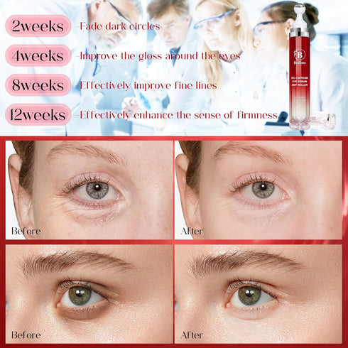 Caffeine Eye Cream for Dark Circles: Morning Wake Up Under Eye Serum for Puffiness Bags Wrinkles Daily Skincare for Men Women...