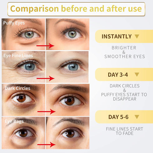 Under Eye Patches - 60 Pcs - 24K Gold Eye Mask- Puffy Eyes & Dark Circles Treatments,Reduce Under Eye Bags and Smooth Wrinkles,Eye Skin Care Pads ...