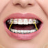 JMU Orthodontic Elastics 3/8 Heavy, 300 Pack Orthodontic Rubber Bands, Intraoral Elastic Bands Latex Dental Rubber Bands Made in USA...
