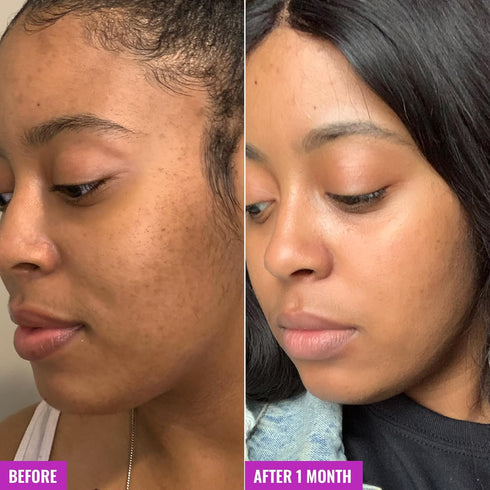 Good Molecules Glycolic Exfoliating Toner - Facial Toner and Exfoliant with Glycolic Acid, Hyaluronic Acid and Aloe to Moisturize - Skincare for F...