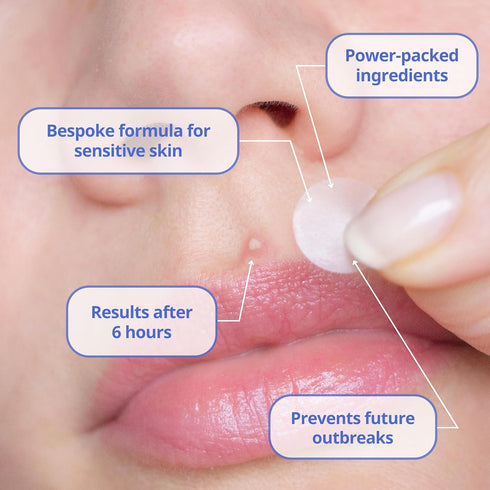 The Sensitive Skin Patch (48 Patches) | Bespoke Formula Pimple Patches for Face | Clear Skin, Gentle Touch | Results After 6 Hours | Strategically...