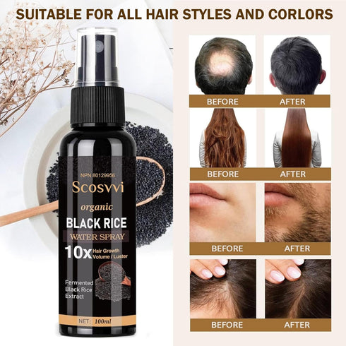 Rice Water For Hair Growth Serum: Hair Loss Treatments For Women And Men - For Dry Damaged Hair With Castor Oil Ginger And Fermented Rice - Hair G...