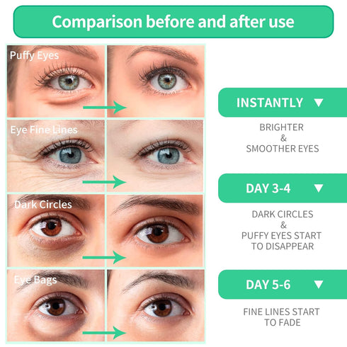 BREYLEE Aloe Vera Eye Mask– 60 Pcs - Puffy Eyes and Dark Circles Treatments – Look Younger and Reduce Wrinkles and Fine Lines Undereye, Improve an...