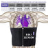 Everyday Medical Abdominal Binder Post Surgery – with Bamboo Charcoal Accelerate Healing and Reduce Swelling After C-Section, Abdomen Surgeries, T...