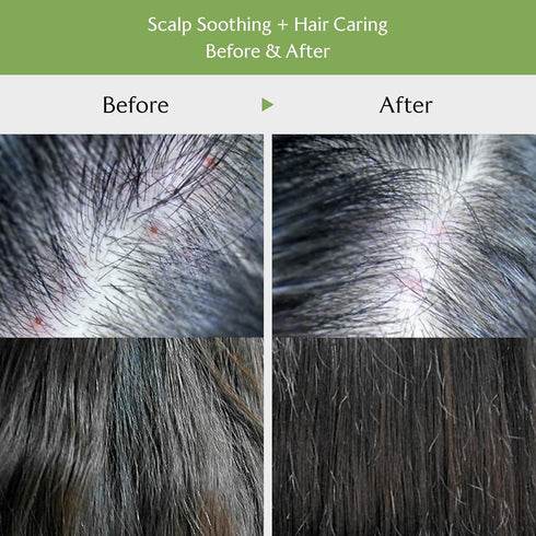 LA'DOR Tea Tree Scalp Clinic Hair Pack - Calming & Nourishing w/Snail Mucin, Tea Tree, Green Tea, Aloe - Hair Conditioning Treatment Mask for Itch...