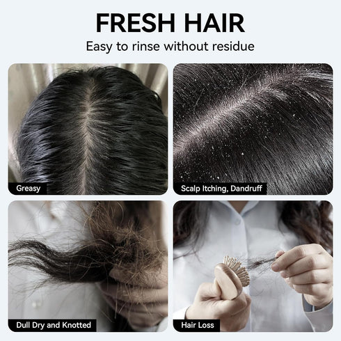 Mint Hair Shampoo Bar, Deep Cleansing for Hair & Scalp Hair Loss Shampoo Soap, Organic Shampoo Bar Oil Control, 0 Silicone Oil...