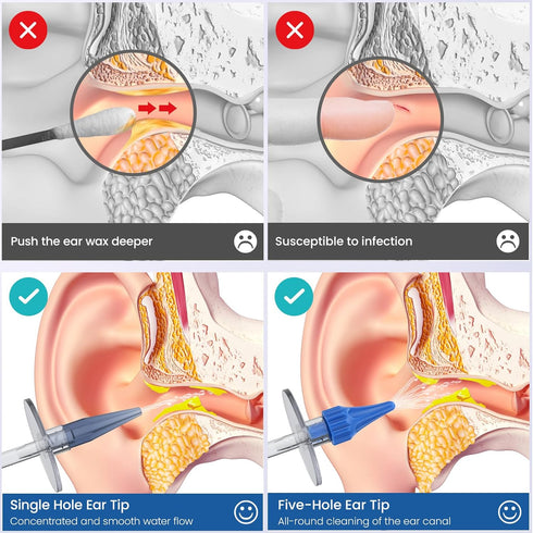 Ear Wax Removal, Ear Wax Removal Tool, Ear Cleaning Kit, Manual Ear Irrigation Flushing System, Safe and Effective to Clean Ear Built Up Wax...