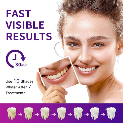 BESTEK Teeth Whitening Strips 28 Treatments, 56 Teeth Whitening Strips - Whitening Strip for Teeth Sensitive, Professional Whitening Strip Kit, Fa...