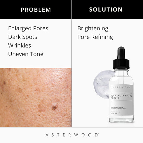 ASTERWOOD Niacinamide Serum for Face - Anti-Aging, Pore Minimizing, Hydrating - Vitamin B3 Facial Serum - with Hyaluronic Acid - Tone, Texture - 1...