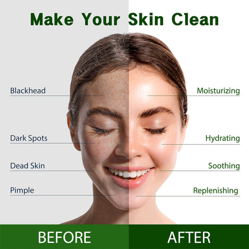 Purederm Vegan Aloe Sheet Masks (12 Packs) – Facial Sheet Mask for Soothing & Hydrating Treatment...