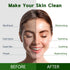 Purederm Vegan Aloe Sheet Masks (12 Packs) – Facial Sheet Mask for Soothing & Hydrating Treatment...