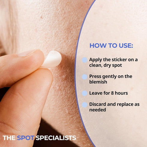 The Sensitive Skin Patch (48 Patches) | Bespoke Formula Pimple Patches for Face | Clear Skin, Gentle Touch | Results After 6 Hours | Strategically...