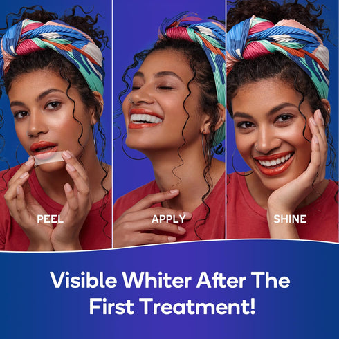 MySmile Advanced Teeth Whitening Strips - Non-Sensitive Formulated 5X Plus Whitening Results, Safe for Enamel - 10 Whitening Strips Dental Stain R...