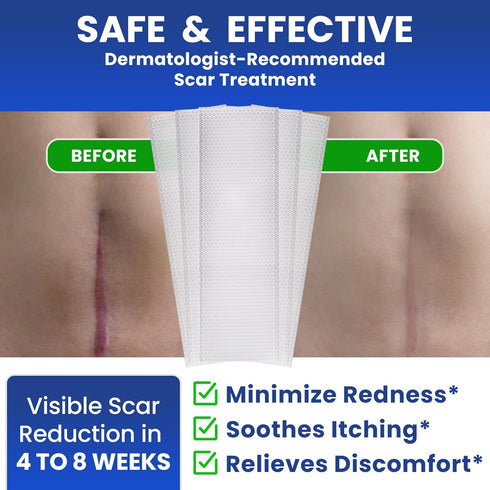 AWD Silicone Scar Sheets for Scar Removal - Extra Thick 0.5mm Silicone Scar Tape for Surgical Scars, C Section, Keloid - Silicone Skin Patches Ext...