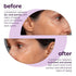 50% Beta Glucan Face Serum Anti-Wrinkle Hydrating Plumping for Dry Skin Fine Line Deep Wrinkle Dark Spot Niacinamide Centella Korean Skincare 1.01...