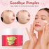 Acne Spot Treatment for Face - Advanced Acne Cream with Salicylic Acid, Pimple and Blemish Spot Treatment, Cystic Acne Treatment & Acne Medication...
