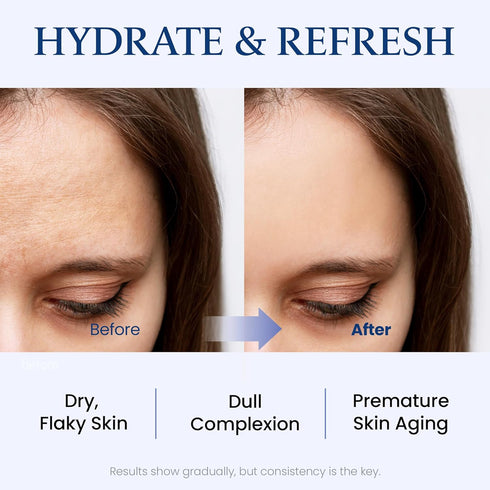 Water Lift Moisture Ampoule for Dry Skin | Deeply Hydrating Serum for Face | Fortifying Facial Serum & Ampoule Korean Skin Care | Highly Moisturiz...