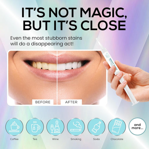 Venus Visage Teeth Whitening Gel Refill Kit Syringes (8 Pack) - 35% Carbamide Peroxide - No Sensitivity Teeth Whitening Gel for Trays - Teeth Whit...