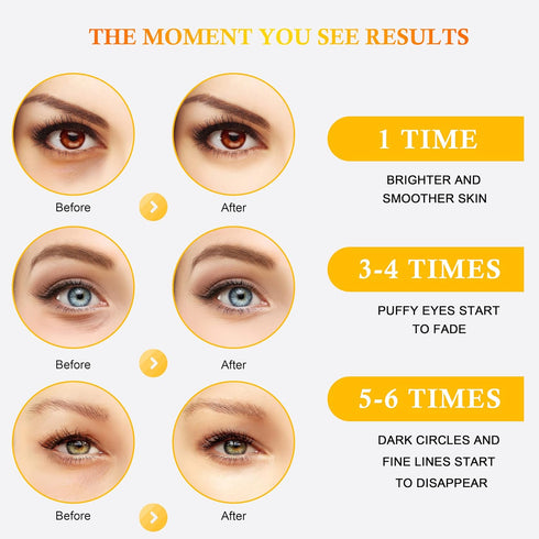REWLKP 24k Gold Eye Collagen Patches - Puffy Eyes & Dark Circles Treatments,Reduce Under Eye Bags and Smooth Wrinkles,Eye Skin Care Pads With Coll...