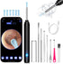 Ear Wax Removal Kit,Ear Cleaner with Camera,Ear Cleaning Kit 1269P HD Otoscope with Lights and 6 Ear Picks, Earwax Removal for Adults and Children...