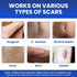 AWD Silicone Scar Sheets for Scar Removal - Extra Thick 0.5mm Silicone Scar Tape for Surgical Scars, C Section, Keloid - Silicone Skin Patches Ext...