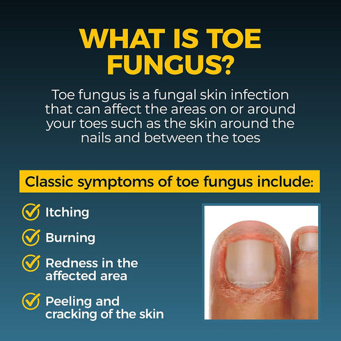 Fungi-Nail Anti-Fungal Liquid Solution, Kills Fungus That Can Lead to Nail & Athlete’s Foot with Tolnaftate & Clinically Proven to Cure and Preven...