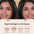 Star Pimple Patches - Hydrocolloid Acne Pimple Patches for Covering Zits and Blemishes, Cute Spot Stickers Skincare Acne Absorbing Cover Patch for...