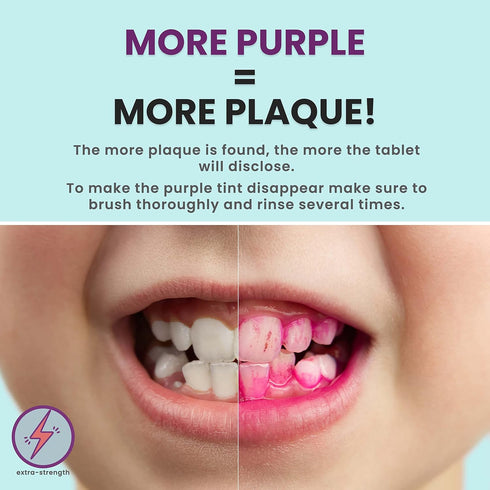 36 Count, Plaque Dental Disclosing Tablets for Kids or Adults, Shows Plaque, Helps Teach Brushing Habits for Clean Teeth, by Fresh Knight, Pack of...