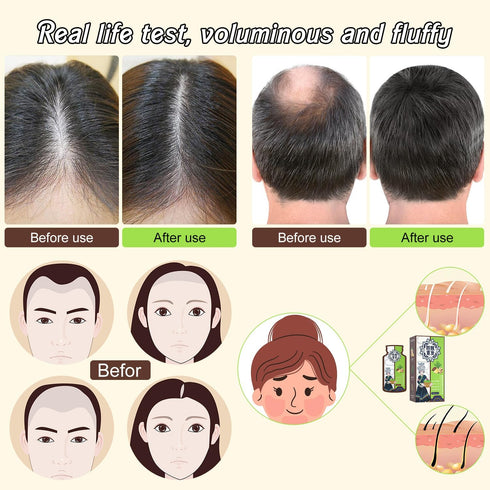 Ginger Plant Extract Anti-Hair Loss Hair Shampoo,Ginger Extract Shampoo for Hair Thickening,Hair Strengthening Shampoo Ginger Hair Care Shampoo fo...