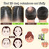 Ginger Plant Extract Anti-Hair Loss Hair Shampoo,Ginger Extract Shampoo for Hair Thickening,Hair Strengthening Shampoo Ginger Hair Care Shampoo fo...