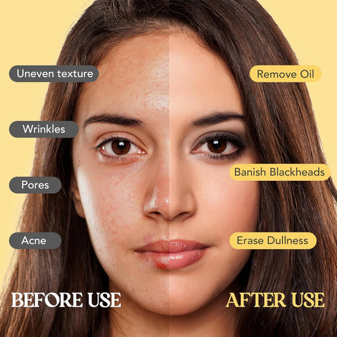 Neatique Vitamin C Clay Mask - Turmeric Skin Treatment, deep purification & detox - evens skin tone, post-acne radiance, polishes complexion, mini...