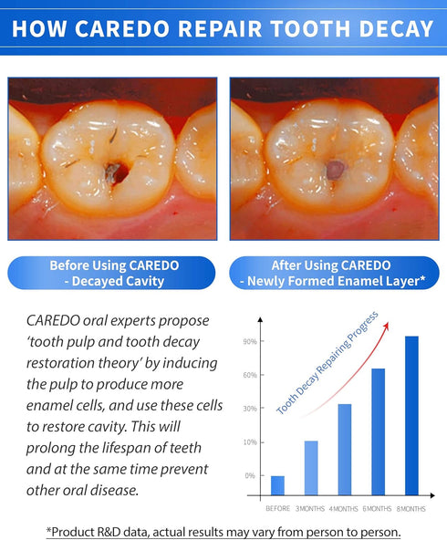 Upgraded Taste - Home Cavity Repair Toothpaste Hydroxyapatite Toothpaste Reverse Cavities Dental Caries, Remineralizing Tooth Decay Treatment for ...