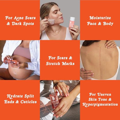 Bio-Oil Dry Skin Travel Skincare Bundle - 1.7 Oz Skincare Oil and 2 Oz Dry Skin Gel...