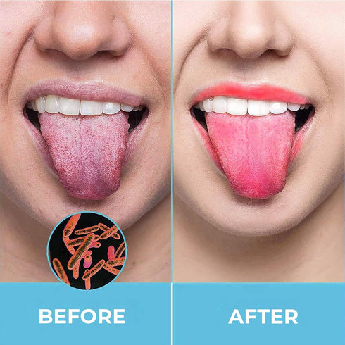 Tongue Scraper for Adults by HOKIN (2Pcs Oral Care Pack) Stainless Steel Tongue Cleaners Reduce Bad Breath 100% Metal tough Scrapers Men and Women...