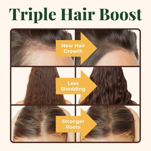 Heebin's Hair Growth Supplements with Biotin 4000 mcg, DHT Blocker and Collagen, for Hair Loss, Thinning and Regrowth, 60 Tablets, 2 Month Supply...