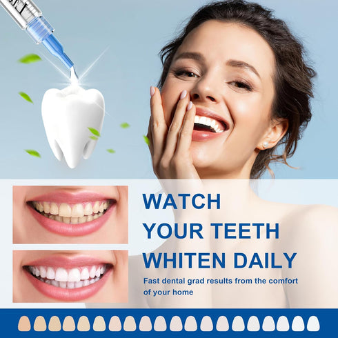 LUCKIN SMILE 10pcs Teeth Whitening Gel Refill with 35% Carbamide Peroxide Suitable for Sensitive Teeth Whitening, Teeth Whiteners used in Conjunct...