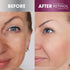 Retinol Anti-Aging, Vitamin Enriched Night Cream & Day Cream - Your 24 HOUR skincare duo that works day and night to give you younger-looking skin...