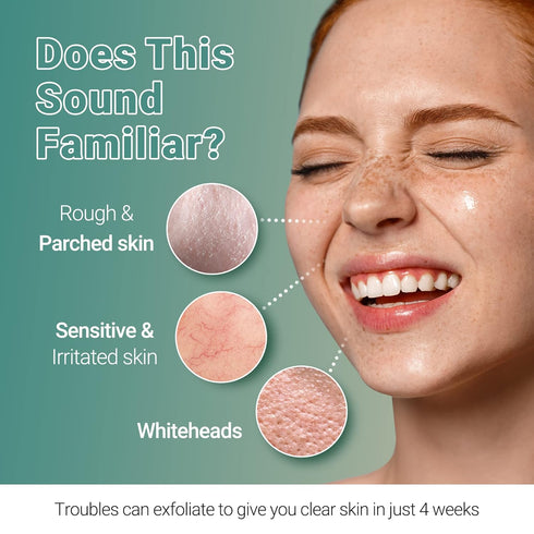 Clear Whitehead Remover Peel Off Face Mask 5pcs. | Hydrating Face Mask Beauty Sheets Day and Night Moisturizer for Face | White and Blackhead Remo...