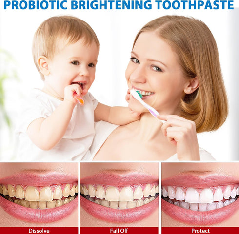 Sp-6 Ultra Whitening, Sp 6 Toothpaste, Ultra Whitening Toothpaste Sp - 6, Probiotic Brightening Toothpaste, Deep Cleaning Care Toothpaste 120g (2P...