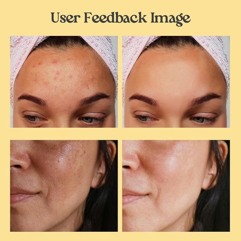 Neatique Vitamin C Clay Mask - 7.05 Oz Turmeric Face Masks Skincare, Deep Cleaning and Detox for Facial Mask- Repairing Uneven Skin Tone, Enhances...